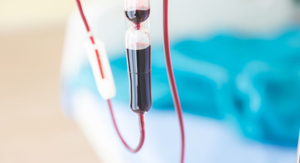 Close-up of an intravenous blood transfusion drip, highlighting a procedure similar to high dose ozone therapy, with a hospital bed and blue sheets blurred in the background.
